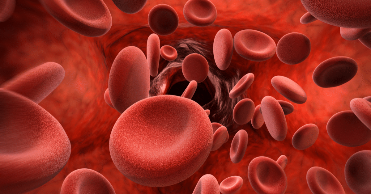 image of bloodclot in a vein