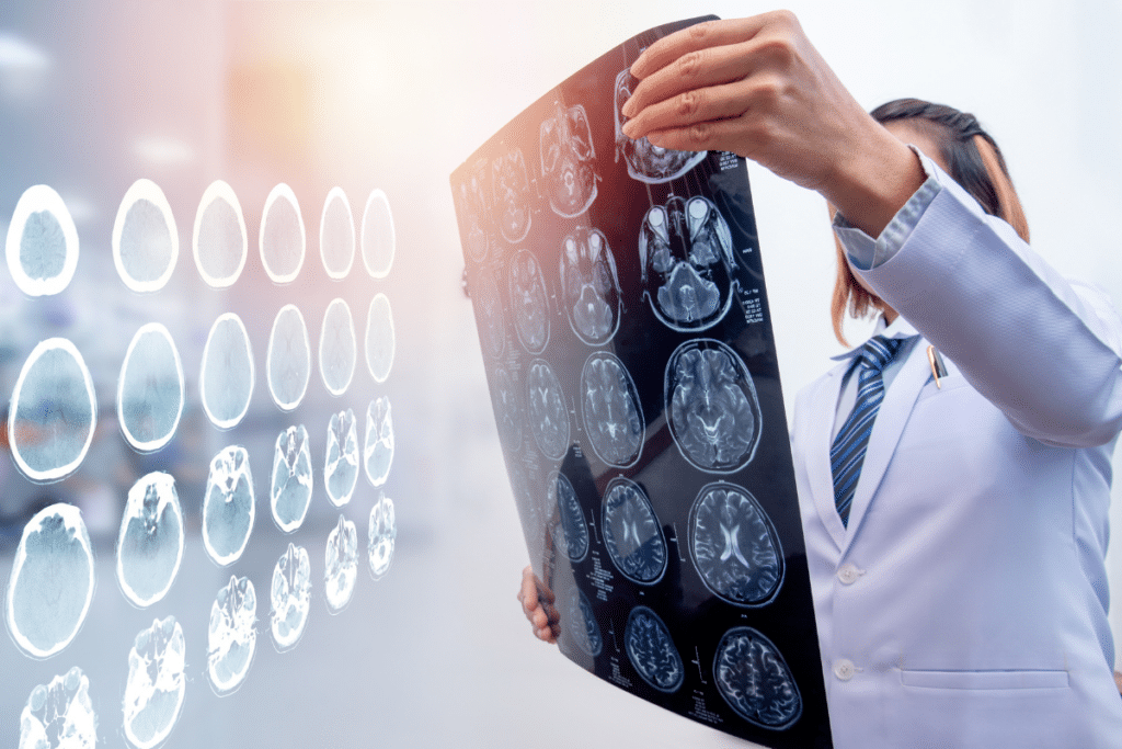doctor holding images of brain xrays