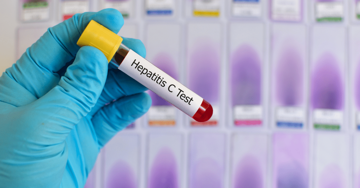 hep c blood test sample