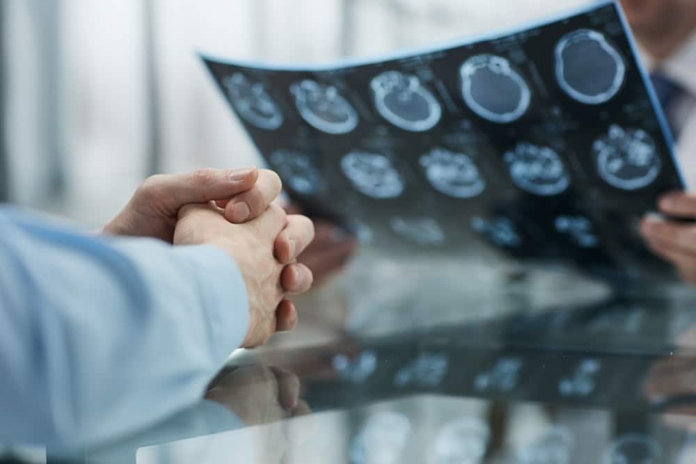 Doctor reviewing a brain CT scan with a patient during a consultation
